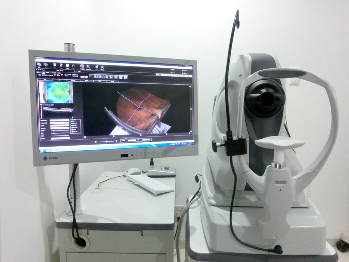 OCT(OCT(optical coherence tomography)