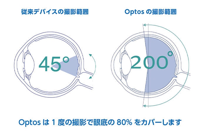 optsは1度の撮影で眼底の80%をカバーします