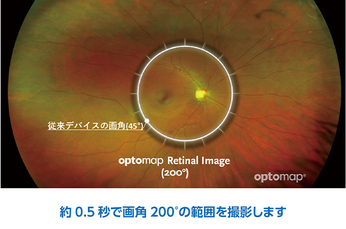 0.5秒で画角200°の範囲を撮影します